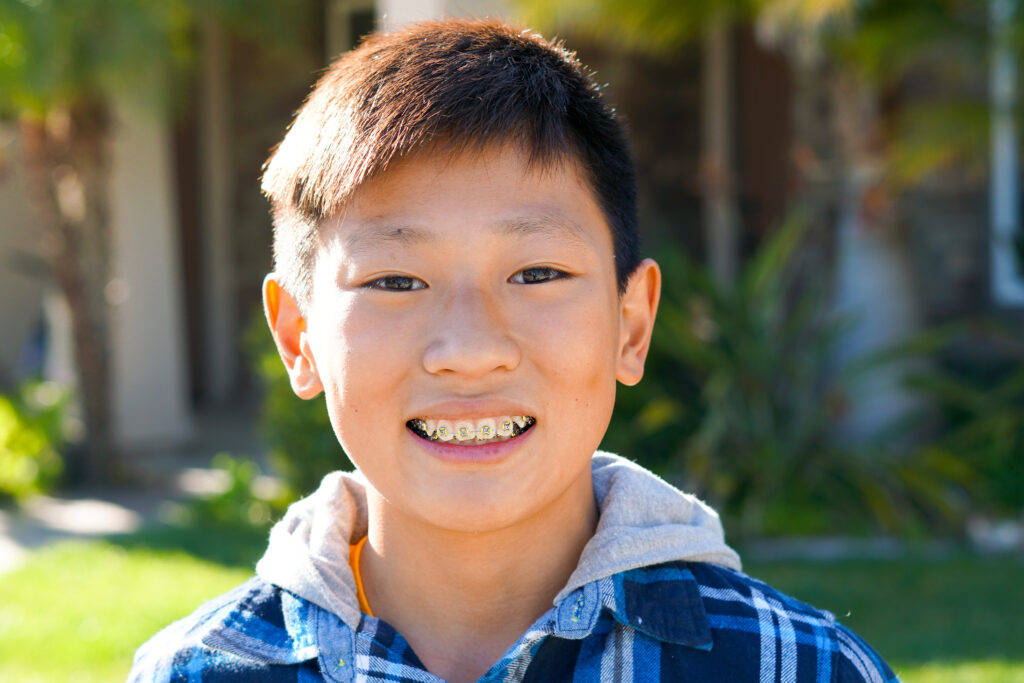 early orthodontic treatment bountiful UT